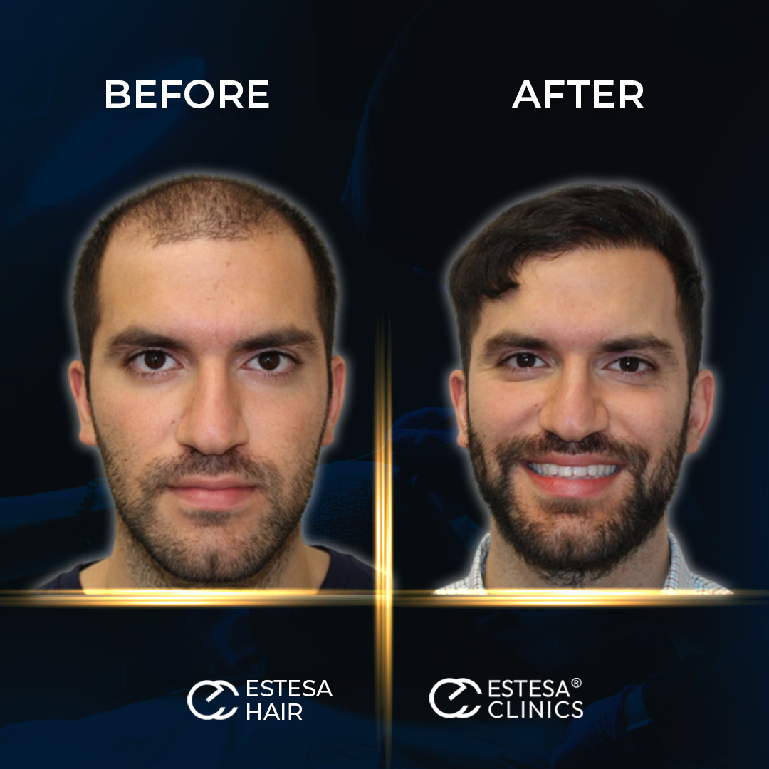 BEFORE AFTER7