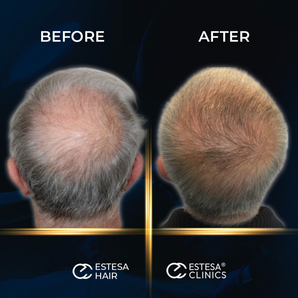 BEFORE-AFTER3
