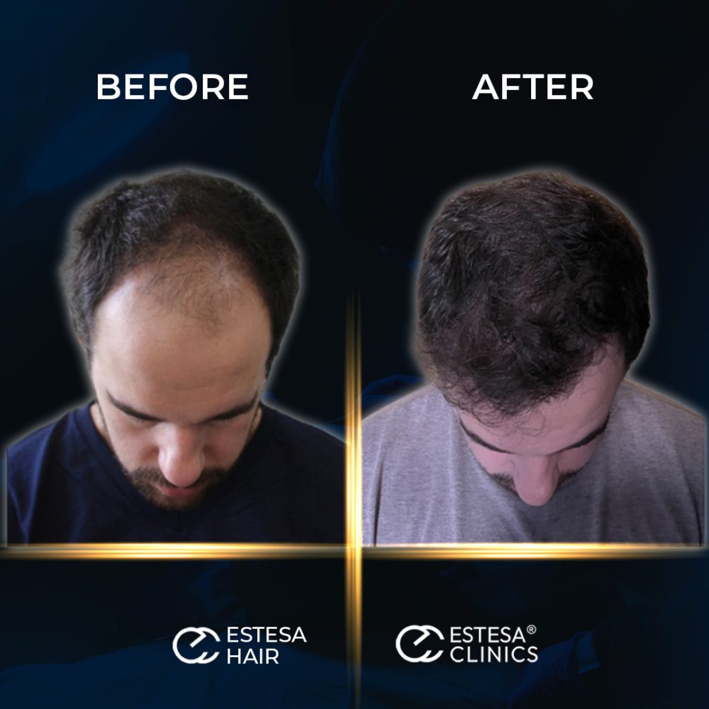 BEFORE-AFTER6
